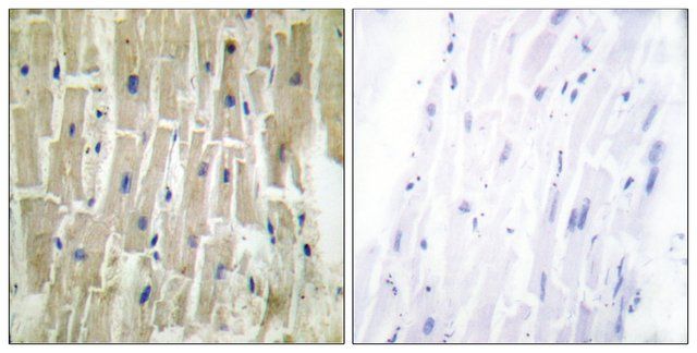 Anti-PDLIM1 antibody produced in rabbit