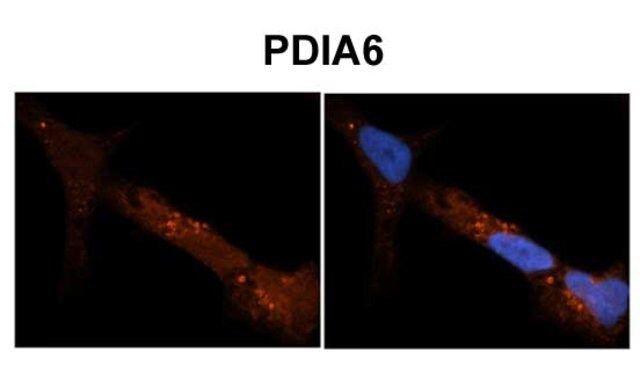 Anti-PDIA6 (ab2) antibody produced in rabbit