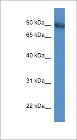 Anti-PDE4D antibody produced in rabbit