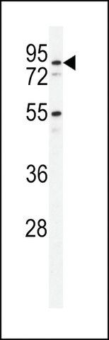 ANTI-PDXD1 (C-TERMINAL) antibody produced in rabbit