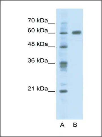 Anti-PDLIM5 (ab2) antibody produced in rabbit