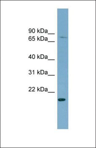 Anti-PDZRN4, (N-terminal) antibody produced in rabbit