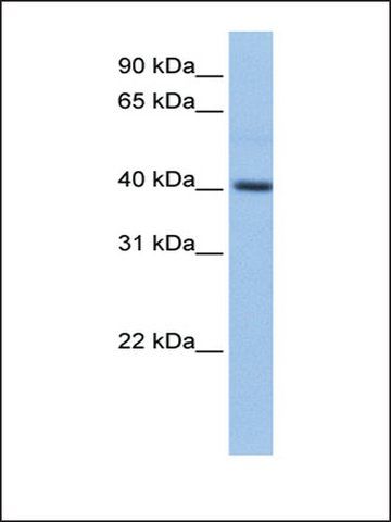 Anti-PDXK (AB2) antibody produced in rabbit