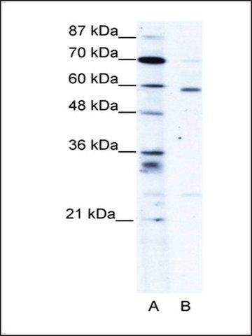 Anti-PDLIM5 (ab1) antibody produced in rabbit