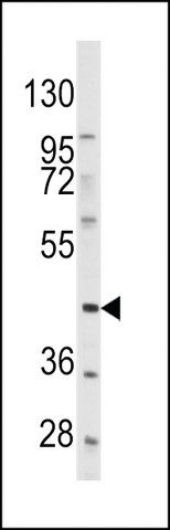 ANTI-PDGFRL(C-TERMINAL) antibody produced in rabbit