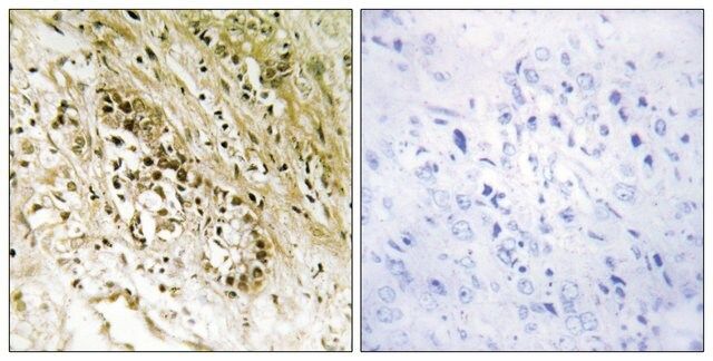 Anti-PDZD2 antibody produced in rabbit