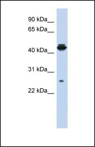 Anti-PDIK1L antibody produced in rabbit