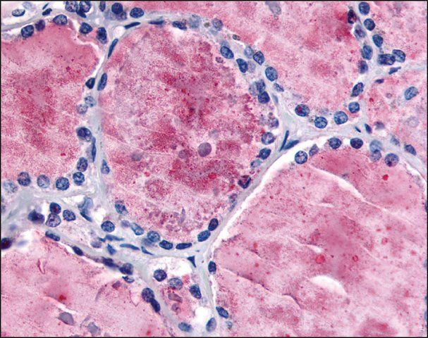 Anti-PDE8B antibody produced in rabbit