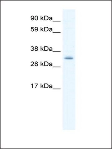 Anti-PDLIM1 antibody produced in rabbit