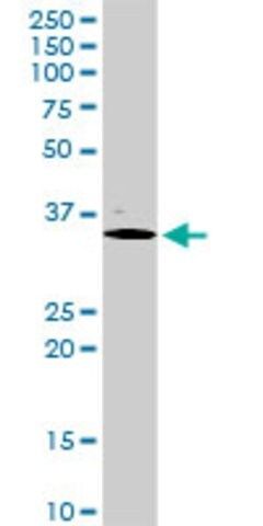 Anti-PDX1 antibody produced in rabbit