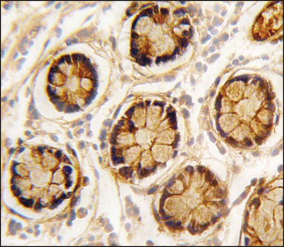 Anti-PDGFRL (C-term) antibody produced in rabbit