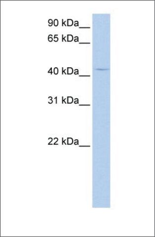 Anti-PECI antibody produced in rabbit