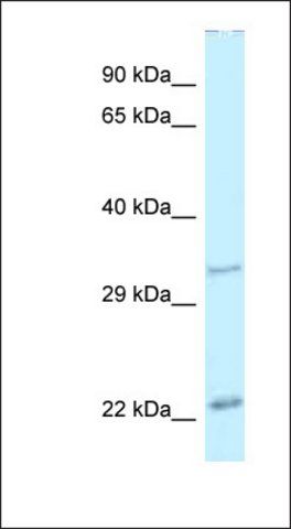 Anti-PDX1 antibody produced in rabbit