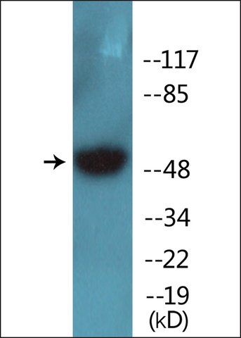 Anti-phospho-Breast Tumor Kinase (pTyr<sup>447</sup>) antibody produced in rabbit