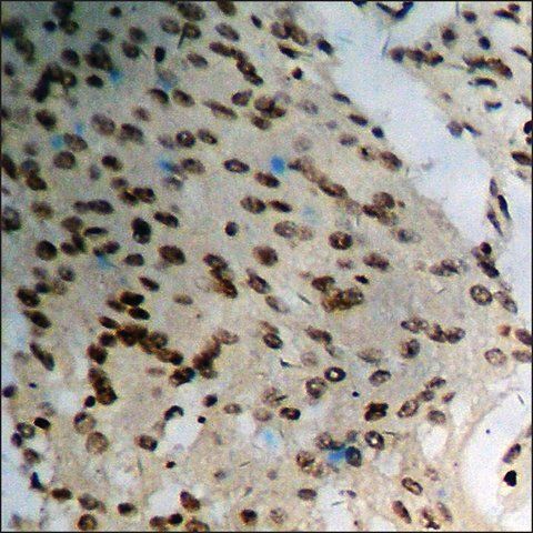 Anti-phospho-BRCA1 (pSer<sup>1423</sup>) antibody produced in rabbit