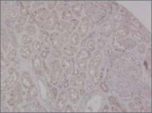 Anti-MSH2 antibody produced in rabbit