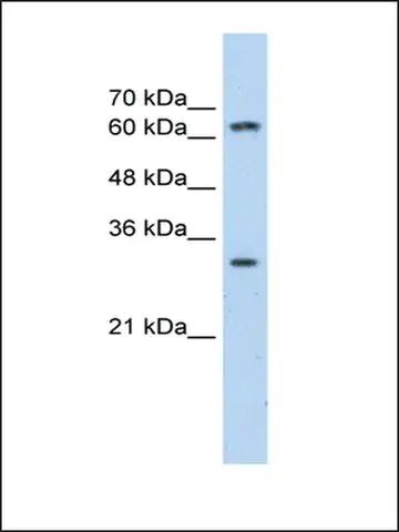 Anti-MTA2 (AB2) antibody produced in rabbit