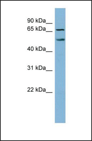 Anti-MYST1, (N-terminal) antibody produced in rabbit