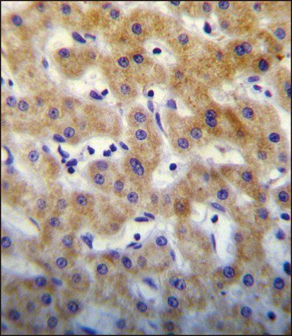 ANTI-KTAP2 (C-TERM) antibody produced in rabbit