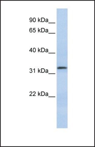 Anti-LACTB2 antibody produced in rabbit