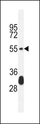 ANTI-KT33A (N-TERM) antibody produced in rabbit