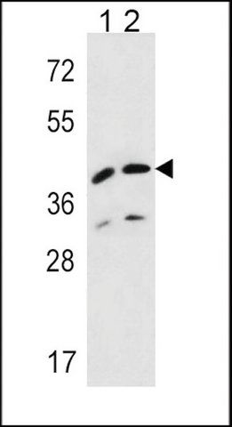 ANTI-L2HGDH (CENTER) antibody produced in rabbit