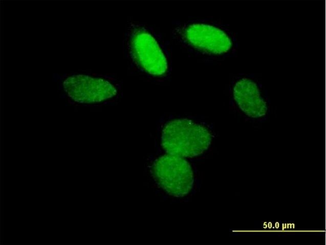 Anti-L3MBTL antibody produced in mouse