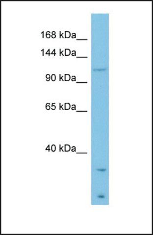 Anti-LAMB3 antibody produced in rabbit