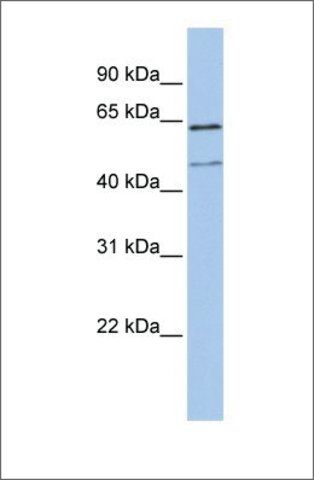 Anti-LAMP3 antibody produced in rabbit