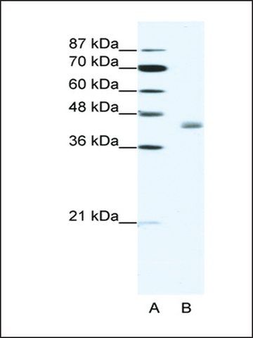 Anti-LDB2 (AB2) antibody produced in rabbit