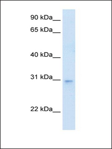 Anti-LDB3 antibody produced in rabbit