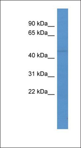 Anti-LCOR antibody produced in rabbit