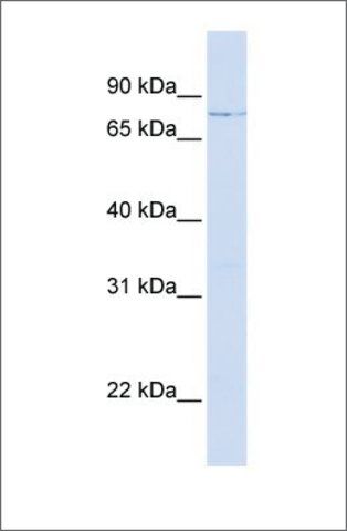 Anti-LCP1 (ab1) antibody produced in rabbit