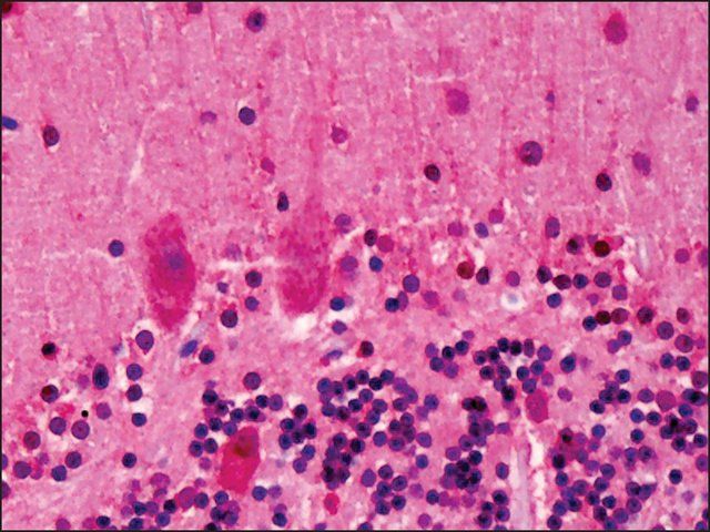 Anti-LGI2 antibody produced in rabbit