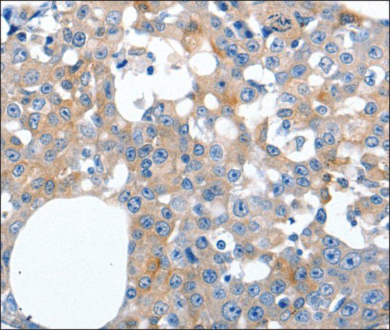 Anti-LILRB3 antibody produced in rabbit