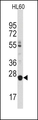 Anti-LIN28B (N-term) antibody produced in rabbit