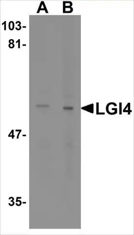 Anti-LGI4 (ab1) antibody produced in rabbit