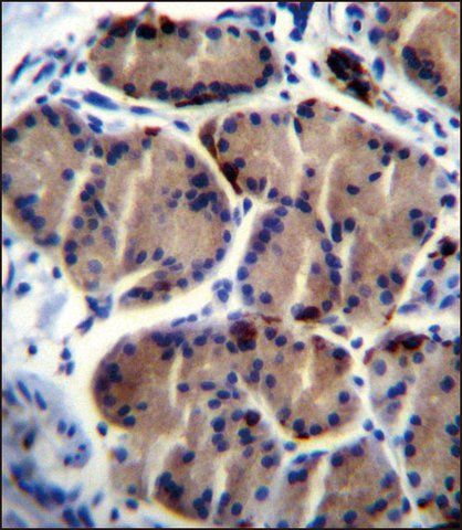 ANTI-LIPC (CENTER) antibody produced in rabbit