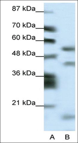 Anti-LHX1 (AB1) antibody produced in rabbit