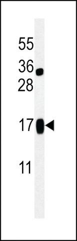 ANTI-LIMD2(N-TERMINAL) antibody produced in rabbit