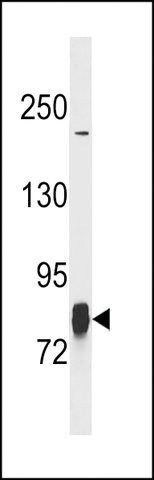 ANTI-LIM KINASE 1 (LIMK1)(N-TERMINAL) antibody produced in rabbit