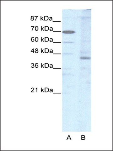 Anti-LHX2 antibody produced in rabbit