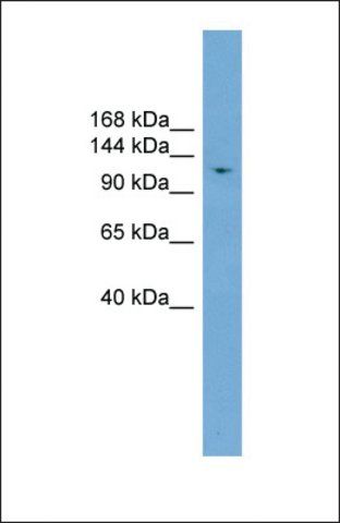 Anti-LIG1 antibody produced in rabbit