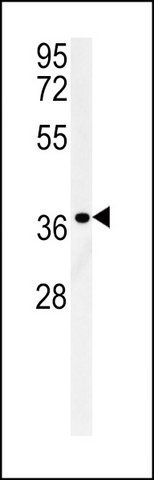 ANTI-LGALS9B (CENTER) antibody produced in rabbit