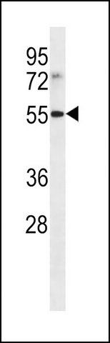 ANTI-LILRB4 (N-TERM) antibody produced in rabbit