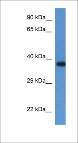 Anti-LOC100047915 antibody produced in rabbit