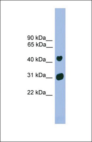 Anti-LHX5 antibody produced in rabbit