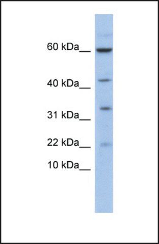 Anti-LMO2, (N-terminal) antibody produced in rabbit