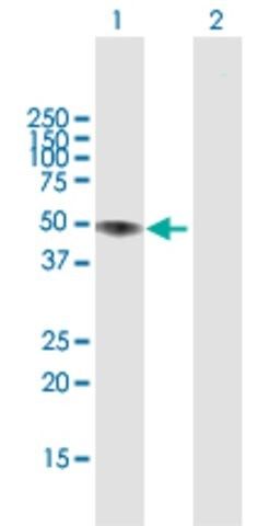 Anti-LIPA antibody produced in rabbit