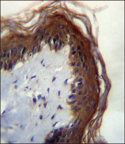 ANTI-LIPM (C-TERM) antibody produced in rabbit